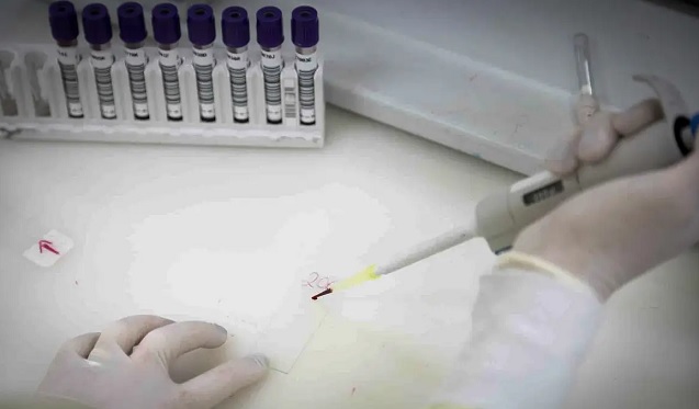 São Paulo investiga novo caso suspeito de ebola em paciente que esteve na República Democrática do Congo