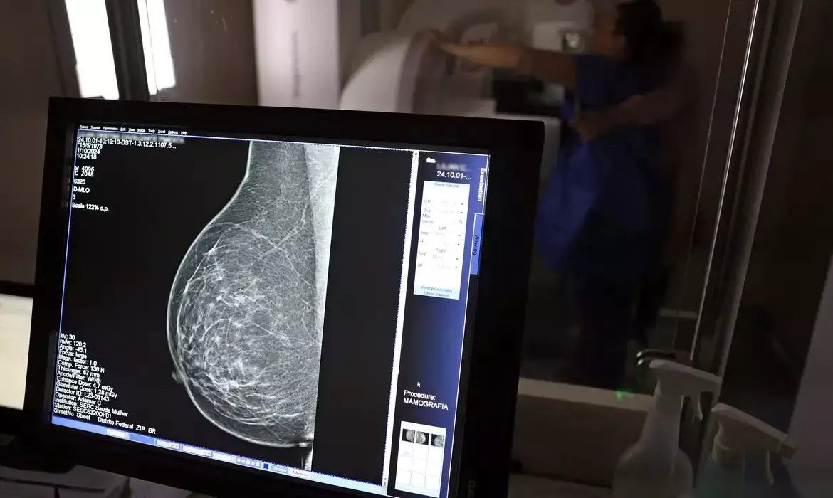 Planos de saúde terão de cobrir mamografia digital sem restrição de idade a partir de outubro